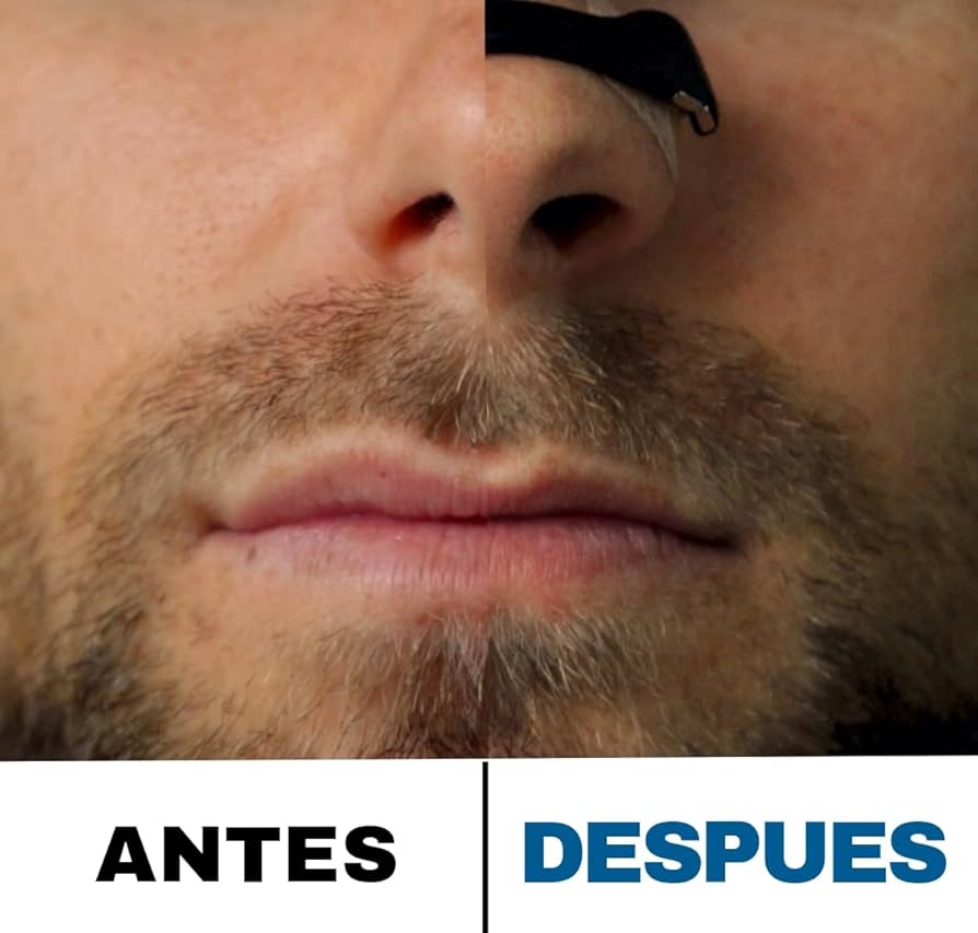 AIRMAX® /  ADIOS RONQUIDOS!